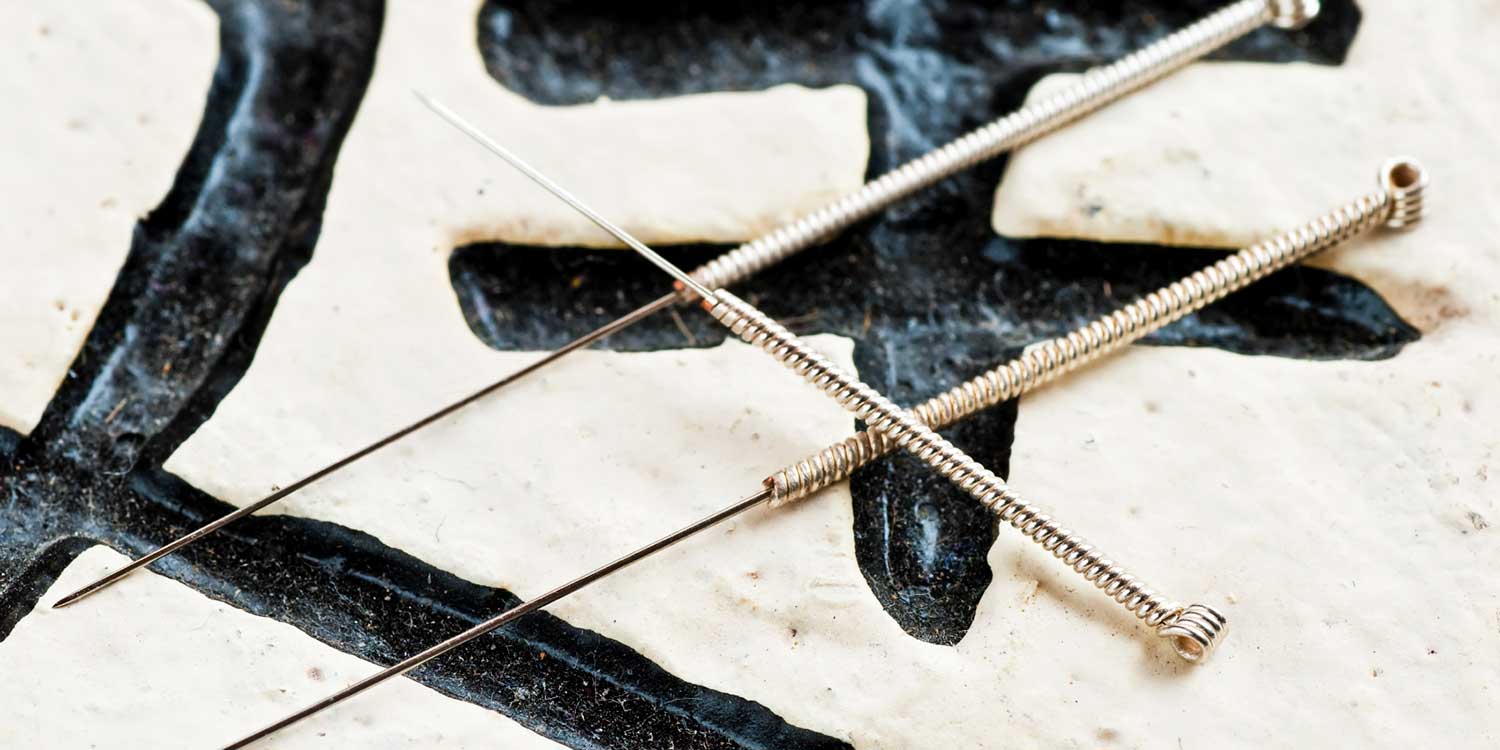 Acupuncture Clark Acupuncture