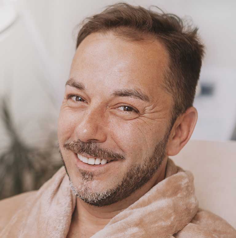 microneedling-miami