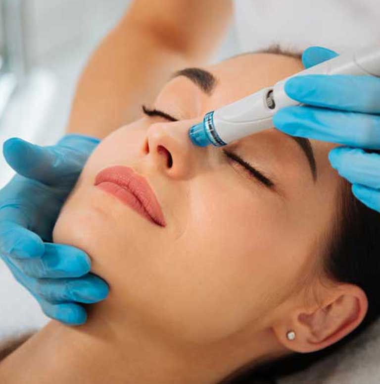 microneedling-miami